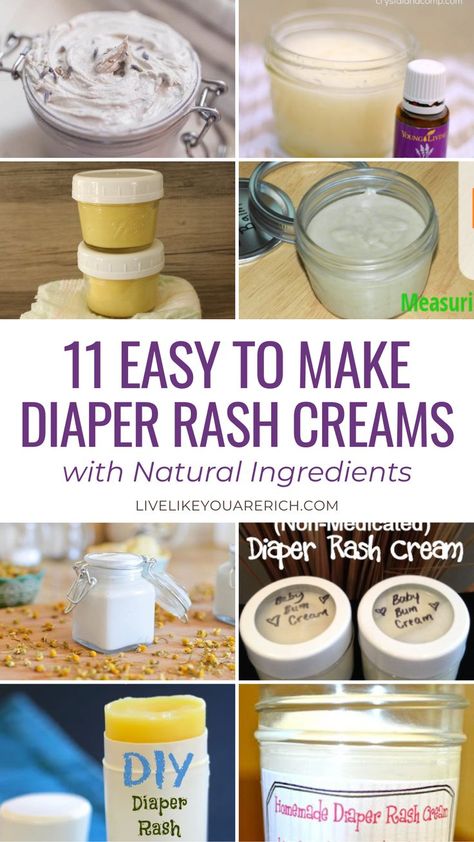 Explore 11 easy-to-make diaper rash cream recipes using natural ingredients. These DIY blends soothe and protect your baby's skin. Perfect for sensitive skin, each formula is carefully designed for effective, gentle relief and prevention of diaper rash. Natural Diaper Rash Remedies, Homemade Diaper Rash Cream, Diaper Cream Recipe, Diaper Rash Cream Recipe, Diaper Rash Remedy, Diy Body Butter, Rash Cream, Diaper Rash Cream, Cream Recipes