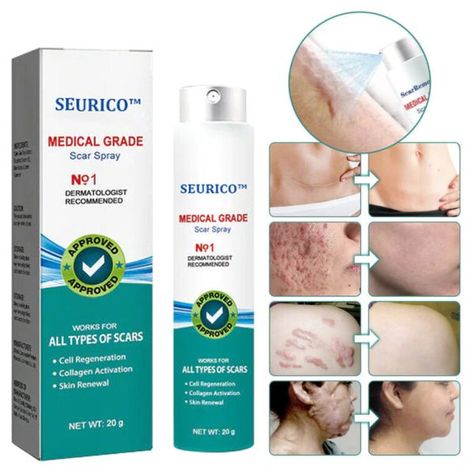 Hypertrophic Scars, Stretch Mark Removal, Cell Regeneration, Skin Tissue, Scar Removal, Scar Tissue, Skin Repair, Spray Can, Green Tea Extract