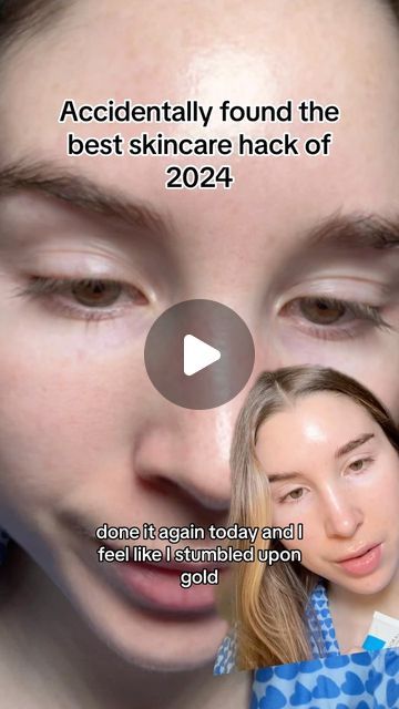 Natalie O’Neill on Instagram: "Sebaceous filaments be gone ✨ I filmed this on the same day that I posted the original 🎀 #sebaceousfilaments #blackheads" Beauty Education, Blackheads On Face, Face Massage Anti Aging, Sebaceous Filaments, Anti Aging Skincare Routine, Fav Products, Get Rid Of Blackheads, Diy Beauty Recipes, Best Skincare