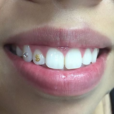 Silver Tooth, Pretty Teeth, Dental Jewelry, Tooth Gems, Tooth Gem, Teeth Jewelry, Diy Bracelets Easy, Jewelry Bracelets Silver, Easy Diy Jewelry