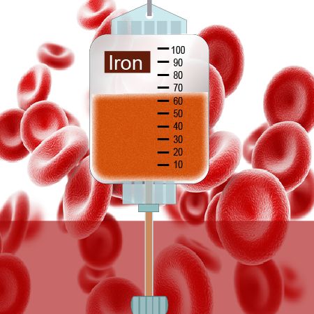 Iron Infusion, Fe Iron, Heart Fail, Electron Transport Chain, Hemoglobin Levels, Iv Infusion, Iron Deficiency, Patient Education, Bone Marrow