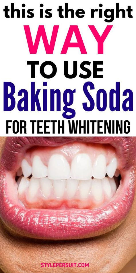 How To Use Baking Soda To Whiten Your Teeth: if you want to explore natural teeth whitening treatments, baking soda is a great option. Read on to know more about the benefits of using baking soda to get pearly white teeth. #teethwhitening #whiteteeth #remedies #homeremedies Peroxide Baking Soda Teeth, Does Baking Soda Whiten Teeth, Brushing Teeth With Baking Soda, Natural Ways To Whiten Teeth, Best Teeth Whitening Toothpaste, Baking Soda And Peroxide Teeth, Tooth Whitening Diy, At Home Teeth Whitening Diy, Whitened Teeth