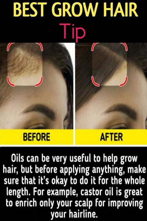 Hair Growth Medicine, Quick Hair Growth, Best Hair Growth, Blonde Hair Care, Hairstyle Tips, Help Hair Grow, Hair Growth Secrets, Transitioning Hairstyles, Hair Regrowth Treatments