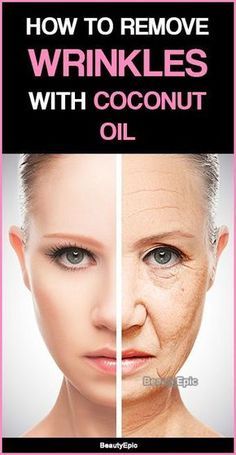 Coconut Oil For Wrinkles, Coconut Oil Facial, Wrinkle Remedies, Coconut Oil Skin Care, Anti Wrinkle Skin Care, Skin Care Wrinkles, Coconut Oil For Skin, Wrinkle Remover, Anti Aging Skin Products