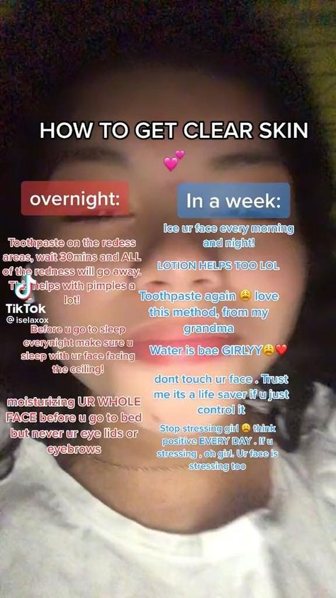 How To Make Skin Clear And Glow, How To Get A Facial Glow Up, How To Get Skin Clear, What Skin Care Products To Use Together, How To Get Clear Skin Naturally Overnight, Good For Acne Clear Skin, To Get Clear Skin, How To Get Natural Clear Skin, Things To Clear Acne