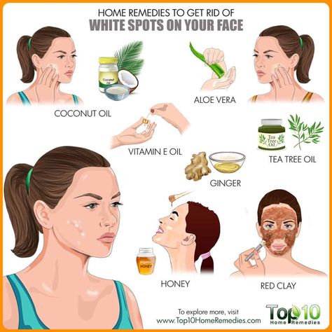 Get rid of white spots on face White Spots On Face, White Spots On Skin, White Skin Spots, Spots On Skin, Back Acne Remedies, Skin Spots, Spots On Face, Flexible Dieting, Autoimmune Disorder