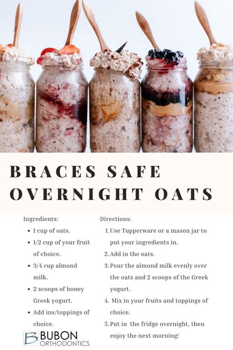 Braces Food What To Eat With, Soft Healthy Foods For Braces, Soft Breakfast Foods For Braces, Best Foods To Eat With Braces, Recipes For Braces Wearers, Braces Friendly Food, Soft Foods For Braces, No Chew Foods After Surgery, Foods To Eat With Braces