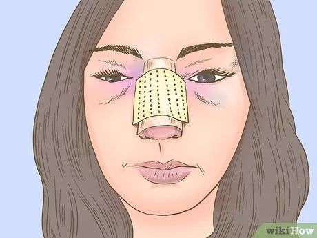 3 Ways to Make Your Nose Look Smaller - wikiHow Wide Noses Women, How To Shrink Nose, Small Eyes Big Nose, Nose Piercings On Big Noses, Contour Long Nose, How To Get Smaller Nose, Nose Bump Side Profile, How To Make Nose Smaller, How To Make Your Nose Smaller