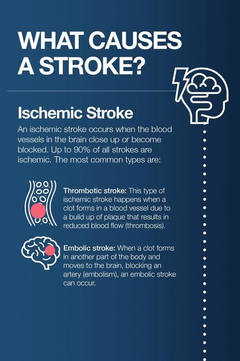 Brain Aneurism, Cardiac System, Types Of Strokes, Brain Surgeon, Amino Acid Supplements, Health And Fitness Magazine, Healthy Diet Tips, Daily Health Tips, Lower Blood Sugar