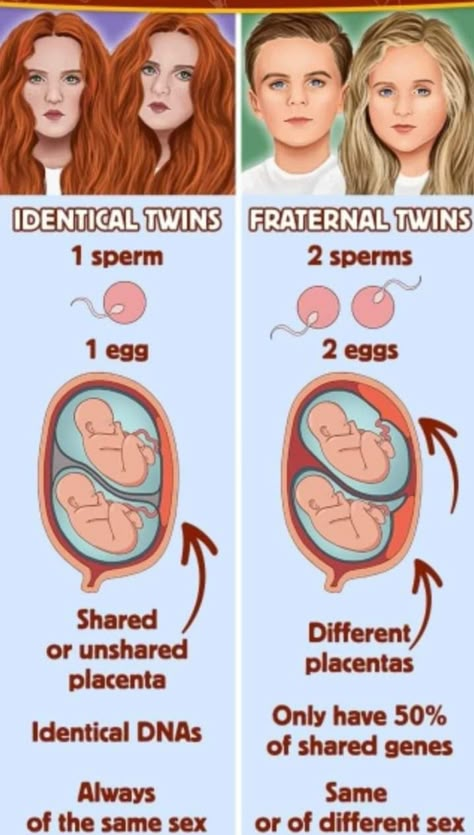 Twins In The Womb, Twins Tips, Midwifery Student, Learn Biology, Pregnancy Facts, Basic Anatomy, Basic Anatomy And Physiology, Nursing Student Tips, Fraternal Twins