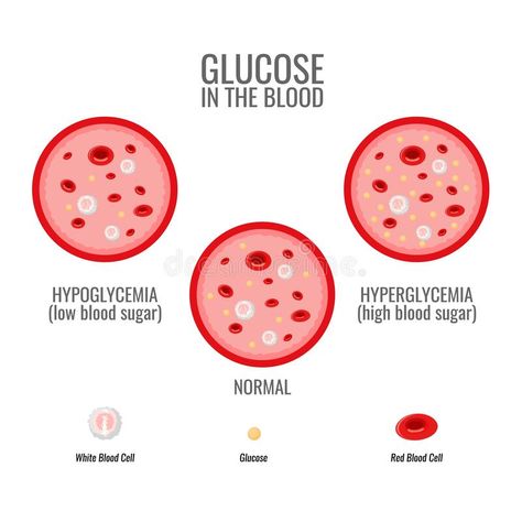 Glucose levels infographic. Vessel and blood health. Vector. Illustration stock illustration Save The Date Posters, Abstract Science, Data Network, Cloud Vector, Medical Symbols, Timeline Design, Low Blood Sugar, Blood Glucose Levels, Glucose Levels