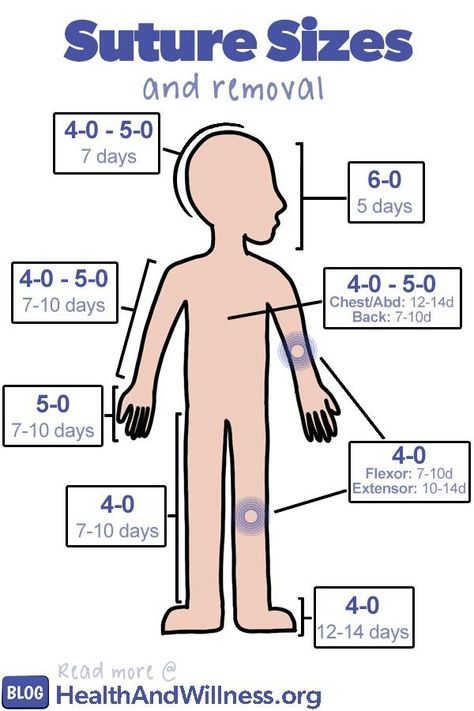 How to suture - suture size and removal How To Dress Like A Nurse Practitioner, Nursing Hacks, Medical Surgical Nursing Cheat Sheets, Suture Types, Types Of Precautions Nursing, Types Of Surgical Sutures, Nurse Practitioner Week, Surgical Wound Classification, Surgical Technologist Student