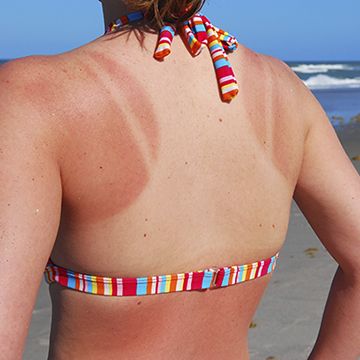 No one has to know about that time you fell asleep on the beach. How To Even Out Tan Lines, How To Get Rid Of Tan Lines, Tanning Lines, Bad Tan Lines, Get Rid Of Tan, Home Remedies For Sunburn, Natural Remedies For Sunburn, Farmers Tan, Sunburn Remedies