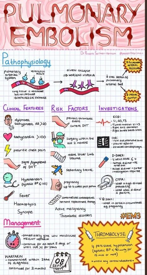 Pulmonary Embolism Infographic Pathophysiology Nursing, Paramedic School, Nursing Information, Nurse Study Notes, Nursing Mnemonics, Nursing Student Tips, Cardiac Nursing, Nursing School Survival, Critical Care Nursing