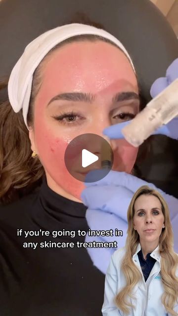 YMD Facial Plastic Surgery | PRP vs PRFM! 🥊  If you live in Orlando, Florida and you want to get this procedure done, click the link in my bio and schedule a free ... | Instagram Prp Undereye Before And After, Mewing Before And After, Prp Facial, Facial Procedure, Body Makeover, Plastic Surgery Procedures, Hydra Facial, Facial Plastic Surgery, Neck Lift