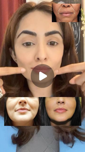 Face Reduce Exercise, Face Yoga For Mouth Wrinkles, Best Face Yoga Exercises, Best Face Exercises, Smile Line Exercises, Morning Face Yoga, Face Yoga For Smile Lines, Face Excercise Smile Lines, How To Lift Face Naturally