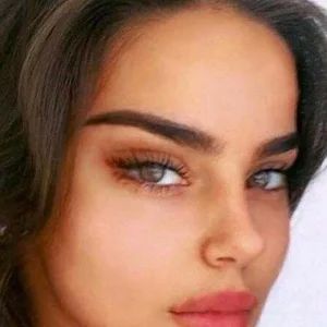 Cat eye look with a temple lift or a lateral canthoplasty? (photos) Cat Eye Surgery Before And After, Cat Eye Surgery, Fox Eye Lift, Faces Aesthetic, Eye Lift Surgery, Cat Eye Look, Facial Surgery, Fox Eyes, Medical Consultation