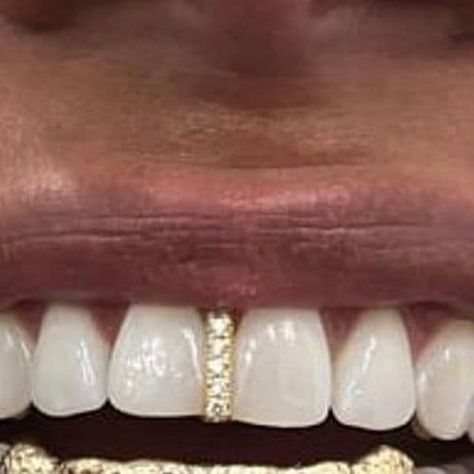 I want a GAP GRILL 🫠😭 Grills On Gap Teeth, Tooth Gap Grill, Gap Teeth Grillz, Tooth Gap Jewelry, Smiley Piercing Gap Teeth, Grills For Gap Teeth, Grillz For Gap Teeth, Grills For Women Teeth Gap, Dainty Grillz