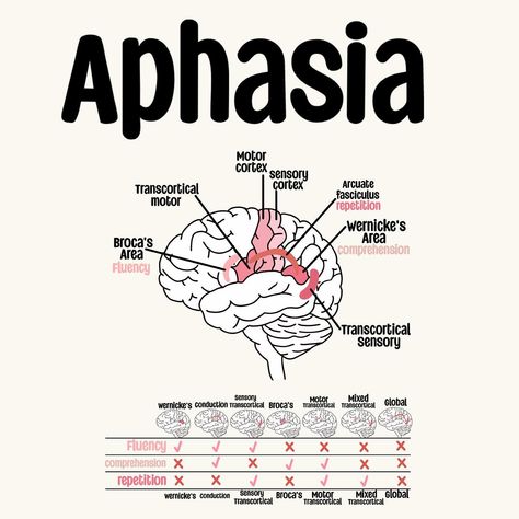 A look at Aphasia 🧠 Study Set Available on my TPT!🩷 . . . . . . . . . . #sIp #speechpathology #sIpgradstudent #sIpgradschool #gradstudent #Speechtherapy #sIpgradlife #speechlanguagepathology #speechlife #slptobe #bilingualslp #cuethespeech #aestheticanatomy #slpaesthetic #lifeisspeechie #fixasha #slpfinds #slpmusthaves #speechfinds #speechie #slpanatomy #anatomy Slp Cheat Sheet, Acute Care Slp, Speech Therapy Aesthetic, Speech Pathology Aesthetic, Speech Language Pathology Grad School, Slp Aesthetic, Praxis Study, Slp Grad School, Speech Language Pathology Assistant