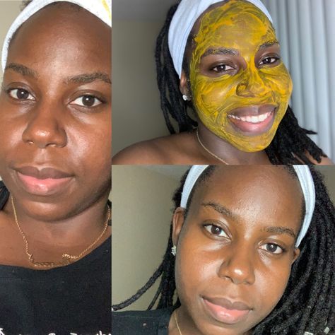 Tumeric Masks, Yogurt Benefits, Apple Cider Vinegar For Skin, My Skin Care Routine, Turmeric Water, Turmeric Health, Organic Apple Cider, Organic Apple Cider Vinegar, Turmeric Powder