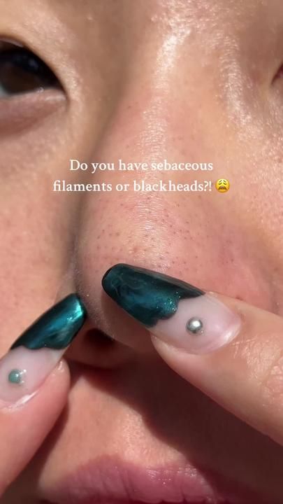 Soo Youn Lee on TikTok Sebaceous Filaments, Rid Of Blackheads, Acne Cleansers, Foaming Face Wash, Perfect Skin Care Routine, Get Rid Of Blackheads, Clearer Skin, Healthy Skin Tips, Facial Skin Care Routine