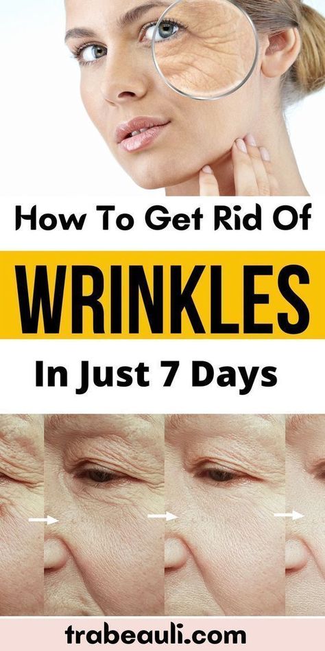 How To Get Rid Of Wrinkles In Just One Week Home Remedies For Wrinkles, Get Rid Of Wrinkles, Lotion For Oily Skin, Wrinkle Remedies, Facial Wrinkles, Skin Care Face Mask, Skin Care Wrinkles, Moisturizer For Oily Skin, Face Wrinkles