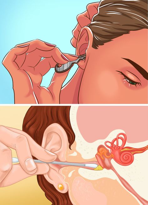 6 Signs You Have an Ear Infection And How to Prevent It Ear Drainage Massage, How To Relieve Pressure In Ears, How To Help Ear Infections, Ear Drops For Infection, Clogged Ear Remedy Sinus Infection, How To Heal Ear Infections Natural Remedies, How To Heal Ear Infections Natural, Eat Infection Remedies, How To Treat Ear Infections At Home