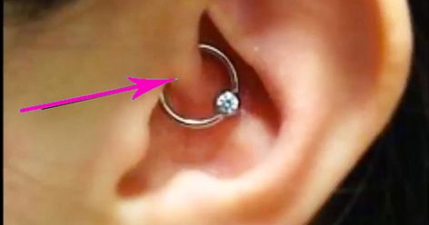 If You Notice Someone With This Kind Of Piercing, THIS Is What It Means & what it does! Daith Piercing Migraine, Ušný Piercing, Migraine Piercing, Inner Ear Piercing, Chronic Migraines, Migraine Relief, Migraine Headaches, Daith Piercing, Bar Studs