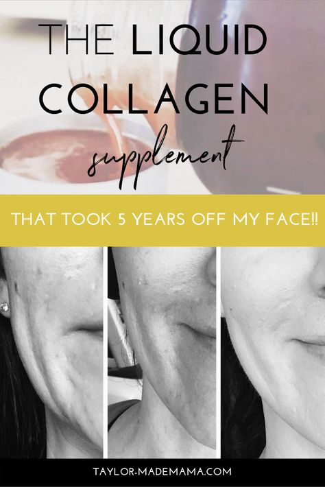 Increase Collagen Production, Liquid Collagen Products, Rejuvicare Collagen, Liquid Collagen Before And After, Best Collagen For Women, Liquid Collagen Benefits, Best Liquid Collagen, Modere Collagen, Modere Trim