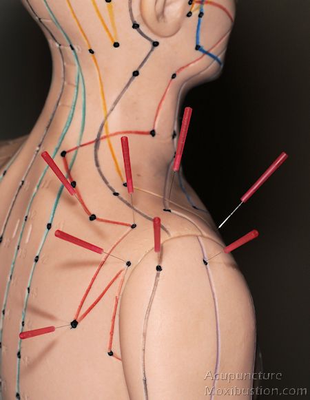 Punkty Spustowe, Acupuncture Points Chart, How To Relieve Nausea, Sinus Pain, Point Acupuncture, Dry Needling, Acupuncture Points, Acupressure Points, Shoulder Pain