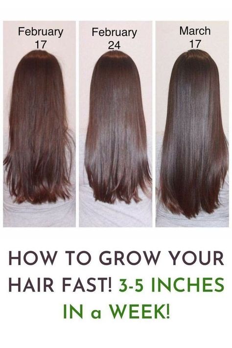 hair growth tips haircare haircare tips aesthetic hair hair tips hair growth oil grow hair faster      
hair growth tips how to grow your hair faster haircare hair growth hair tips hair mask hair care Long Hair Shampoo, Grow Your Hair Faster, Quick Hair Growth, Increase Hair Volume, Hair Fall Solution, Hair Growth Foods, Thicker Fuller Hair, How To Grow Your Hair Faster, Loss Hair