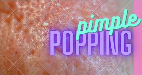 Satisfying Pimple Popping Deep Pimples Under Skin, Huge Pimple Poppìng, Satisfying Pimple Videos, Ear Pimple Poppìng Videos, Huge Pimple Pop Video, Big Pimple Poppìng Videos, Pimple Poppìng Videos New, Popping Pimples Videos, Cystic Pimple Pop