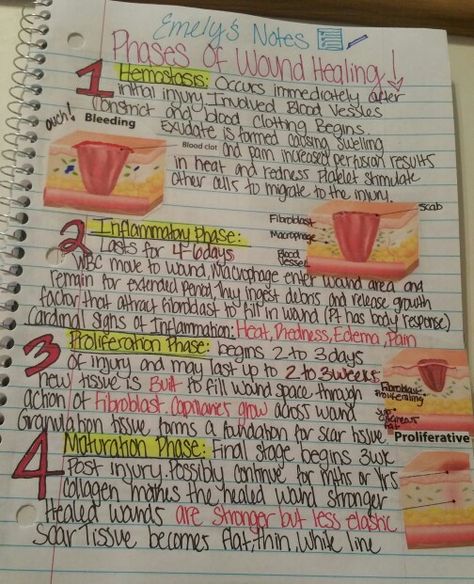 Phases of wound healing: hemostasis,Inflammatory phase,proliferation phase and maturation phase #nursing #notes #wound Wound Care Nursing, Nursing Cheat, Nurse Study Notes, Nursing Mnemonics, Nursing School Survival, Fundamentals Of Nursing, Nursing School Studying, Nursing School Tips, Nursing School Notes