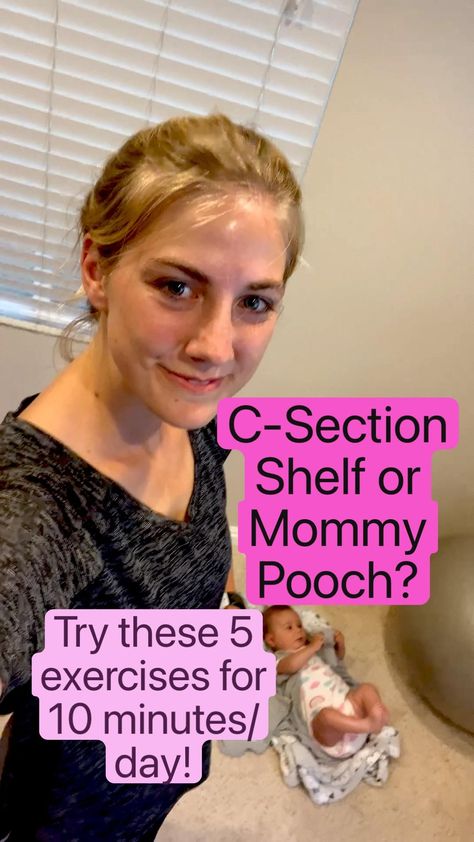 Post C Section Yoga, 4 Week Post Csection Workout, Workouts For Csection Moms, Yoga For C Section Recovery, Postpartum Csection Exercises, Postpartum Csection Workouts, Exercise For Post C Section, Postpartum C Section Workout Plan, Post Csection Ab Workouts