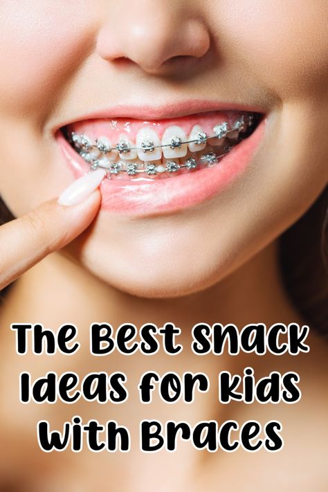 snacks for kids with braces Soft Foods After Getting Braces, Good Foods To Eat With Braces, Easy Meals For Braces, School Lunch Ideas For Kids With Braces, Good Food To Eat With Braces, Best Food To Eat With Braces, Brace Friendly Recipes, Healthy Braces Friendly Snacks, Foods To Eat After Braces