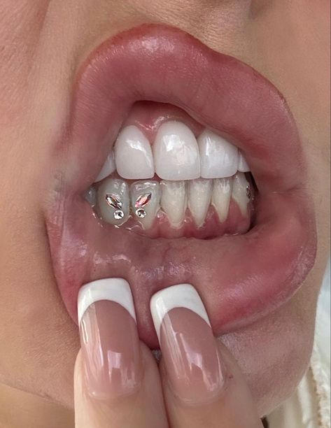 Teeth Gems Butterfly, Bottom Teeth Gems, Tooth Gems Butterfly, Bottom Tooth Gem, Tooth Gems Bottom Teeth, Butterfly Tooth Gem, Teeth Piercing, Teeth Jewels, Inner Lip Tattoo