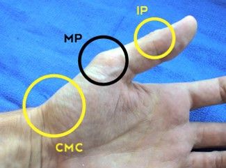 cmc thumb joint, mp thumb joint, ip thumb joint Thumb Pain Relief, Thumb Brace, Thumb Splint, Joints Pain Remedy, Hand Health, Hand Pain, Hand Therapy, Physical Therapy, Pain Relief