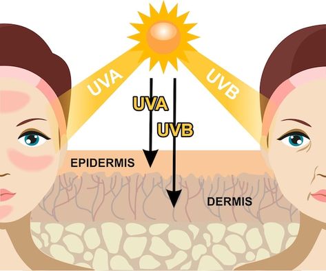 Vector the difference of radiation 2 typ... | Premium Vector #Freepik #vector #uv #uv-rays #uv-light #sun-protection Uv Rays Infographic, Radiation Design Principle, Chemical Sunscreen Vs Physical Sunscreen, Diy Turmeric Face Mask, Drugstore Primer, Importance Of Sunscreen, Best Drugstore Primer, Primer For Oily Skin, Summer Skincare Routine