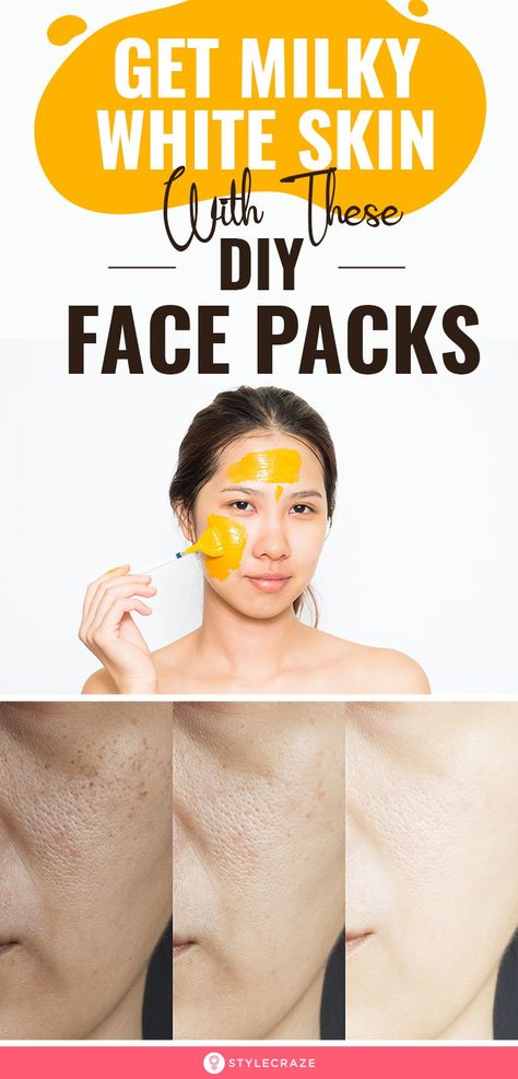 Get Milky White Skin With These DIY Face Packs: If you follow a disciplined skincare routine which includes regular use of the home remedies laid out here, you will be the owner of a pure peaches and cream complexion in no time! Read on to know more about these remedies. #Skincare #SkincareTips #DIY #FaceMasks #FacePacks Ice Cube On Face, Skin Lightening Diy, Proper Skin Care, Peaches And Cream, Beauty Tips For Glowing Skin, Skin Remedies, White Skin, Utila, Beauty Skin Care Routine