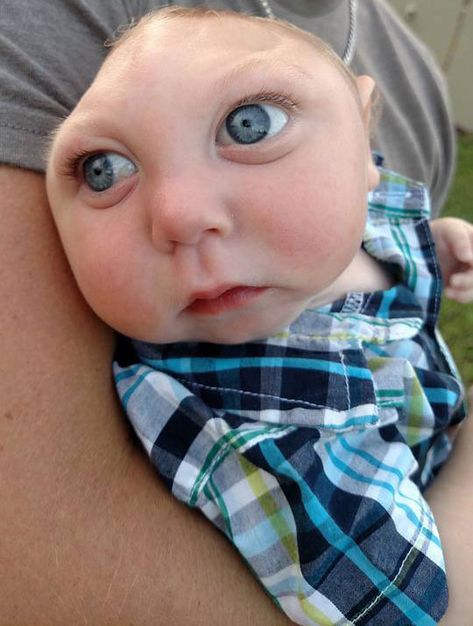 'Miracle Boy' Jaxon Buell, Born with Just Part of His Skull, Dies at 5: 'Strongest Little Boy' Welcome Back Meme, Jank Boteko, Blue Meme, People With Blue Eyes, Silly Pics, Proud Of My Son, Boy Genius, Boy Meme, Blue Eyed Baby