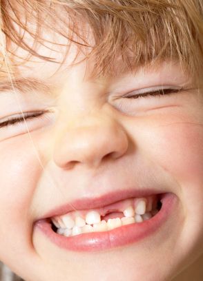 When the tooth fairy forgets, moms unite - GREAT blog post! Radiology Humor, Dental Jokes, Kids Teeth, Loose Tooth, Front Teeth, Funny Nurse Quotes, How To Teach Kids, Vintage Nurse, Dental Teeth