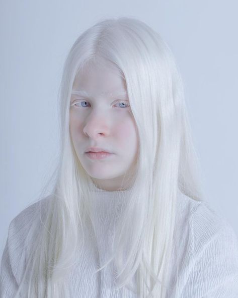 Albino Skin, Albino People, ليلي كولينز, Albino Girl, Coquette Girl, Platinum Hair, Aesthetic People, Face Photo, Jolie Photo