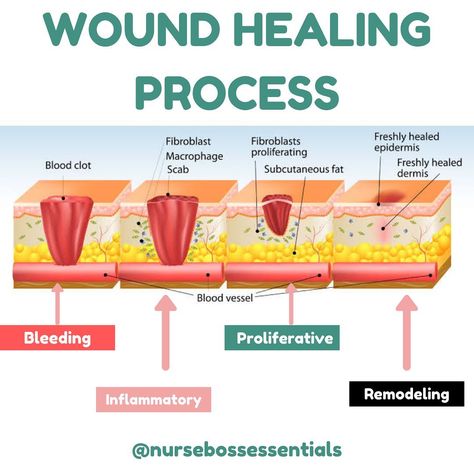 Wound Healing Nursing, Human Placenta, Nurse Practitioner Student, Wounded Healer, Nclex Prep, The Healing Process, Medical School Essentials, Future Nurse, Wound Care