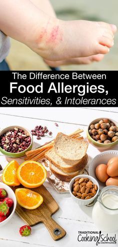 Do you have a food allergy? Wait, a food sensitivity? Or could it be a food intolerance? Do you know the difference between food allergies, sensitivities, & intolerances? Contrary to popular belief, the terms are not interchangeable and knowing which is which isn't as complicated as it seems. Learn the facts, plus the most reliable tests to find out which you may have! Allergies Remedies, Nutrition Careers, Food Sensitivity, Food Allergies Awareness, Anaphylactic Shock, Allergy Awareness, Traditional Cooking, Nutrition Certification, Peanut Allergy