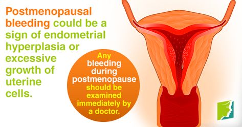 Experiencing postmenopausal bleeding? While the cause is generally minor, it's vital to check with a doctor. Learn more here. Endometrial Hyperplasia, Play Doctor, Natural Hormones, Body Anatomy, Alternative Health, Signs And Symptoms, Health Motivation, A Doctor, Health And Wellbeing