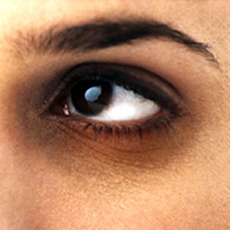 UNDER EYE BAGS AND DARK CIRCLES  If you happen to drink chamomile tea, then do not throw the tea bags after use, store them in the freezer instead. Grate half cucumber and massage it around the eye area. Then place the chilled tea bags on your eyes and lie down for 10 minutes. You will see the difference almost instantly. Clinic Dermatech wants you look your best, always !  ‪#‎10GloriousYears‬ ‪#‎ClinicDermatech‬ ‪#‎LivePowerfully‬ Dark Circle Cream, Dark Eye Circles, Honey Face Mask, Dark Circles Under Eyes, Remove Dark Circles, Beauty Tips For Face, Undereye Circles, Beauty Sets, Dark Eyes