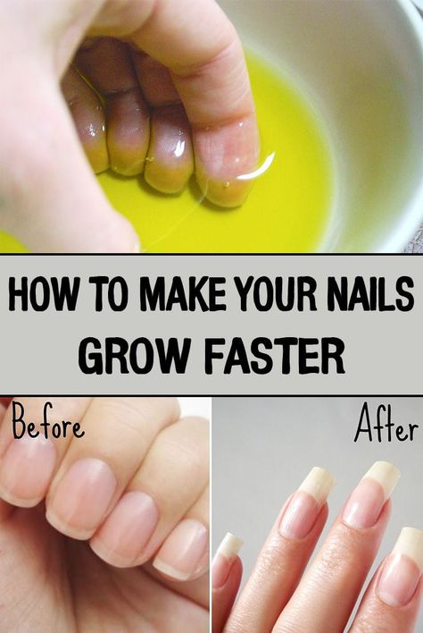 How to grow our nail faster in 2023 Nails Grow Faster, Make Nails Grow, Do It Yourself Nails, Longer Nails, Grow Nails Faster, Fast Nail, Nail Care Tips, How To Grow Nails, Nail Growth