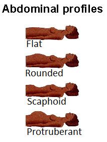 Inspection of Abdomen Abdomen Assessment Nursing, Assessment Nursing, Nurse Notes, Nursing Notes, Nursing School, Assessment, Nursing, Foundation