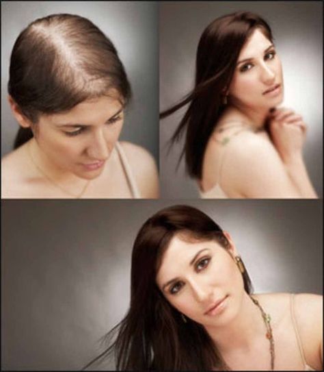 Eat away your hair loss problems! @ http://www.stylecraze.com/articles/eat-away-your-hair-loss-problems/ Natural Beauty Care, Male Pattern Baldness, Hair Regrowth, Latest Hairstyles, Stylish Hair, Grow Hair, Leave In, Fall Hair, Hair Hacks