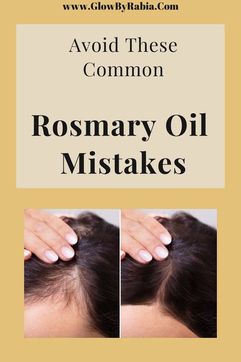 Is rosemary oil worth the hype? Hair loss and hair thinning can be very upsetting and can take a toll on our self-confidence. Check out this pharmacist guide to what you can do today to stop hair from thinning and how to boost hair growth from home. thinning hair| hair thinning women| thinning hair remedies| how to stop hair from falling out| how to stop hair thinning| hair growth| hair growth tips| hair growth faster| rosemary for hair loss Rosemary For Hair, Regrow Thinning Hair, Hair Regrowth Women, Regrow Hair Naturally, Thinning Hair Remedies, Hype Hair, Rosemary Oil For Hair, Healthy Natural Hair Growth, Castor Oil For Hair